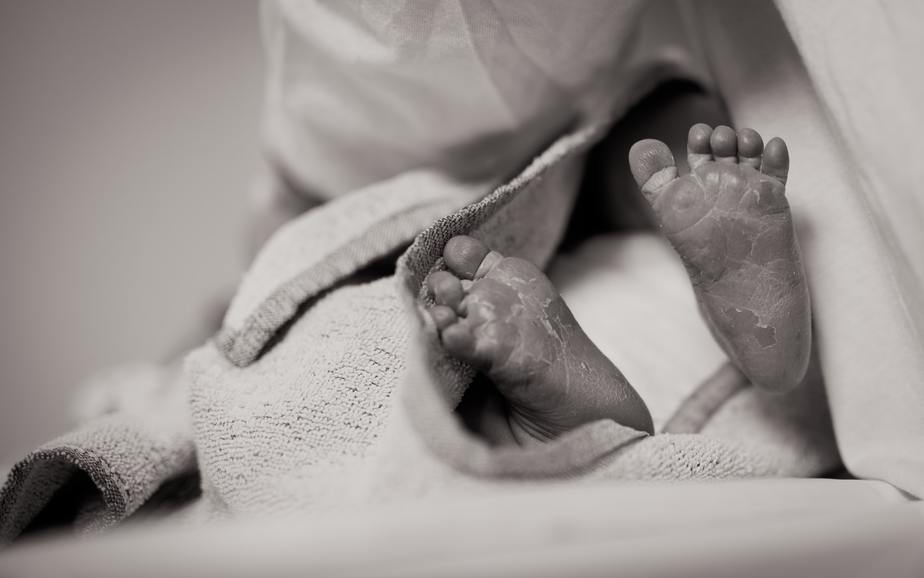 Premature baby complications